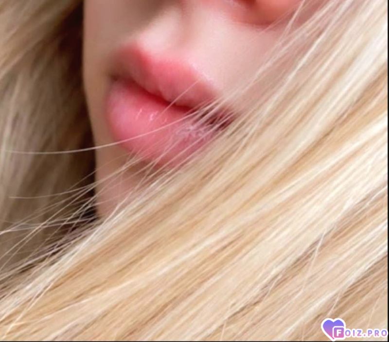 *)
