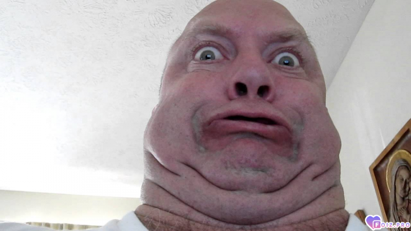 1000087913
