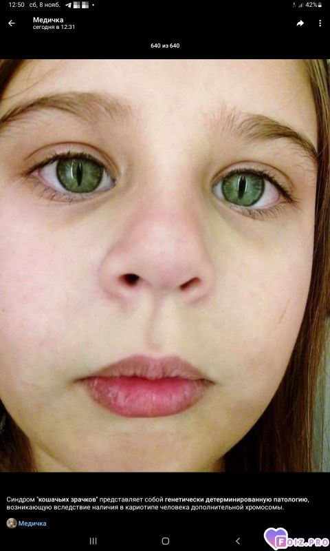 -Кошачьи-Глаза-